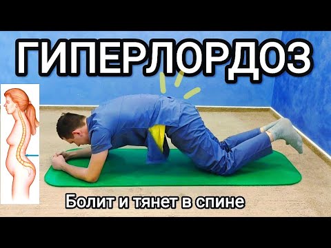 Видео: ГИПЕРЛОРДОЗ - Выпирающий живот, болит спина. Комплекс упражнений.