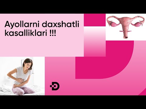 Видео: АЁЛЛАРНИ ДАҲШАТЛИ ЖИНСИЙ КАСАЛЛИКЛАРИ! АЁЛЛАРГА ХОС МАСАЛАЛАР!