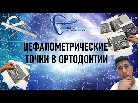 Видео: ЦЕФАЛОМЕТРИЧЕСКИЕ ТОЧКИ В ОРТОДОНТИИ