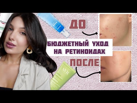 Видео: БЮДЖЕТНЫЙ УХОД ВО ВРЕМЯ ЛЕЧЕНИЯ КОЖИ ОТ ПРЫЩЕЙ \ КАК ВЫЛЕЧИТЬ АКНЕ НАВСЕГДА?