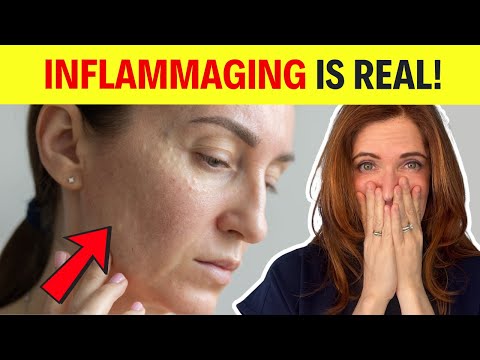 Видео: Как бороться с воспалениями и поддерживать здоровую, сияющую кожу в любом возрасте