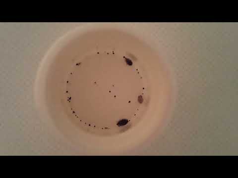 Видео: Клопы постельные и линька такая.