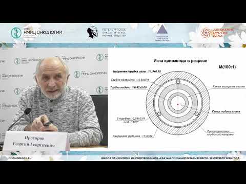 Видео: Криотерапия в лечении больных с костными метастазами