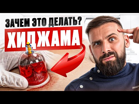 Видео: НЕ делай ХИДЖАМУ, пока НЕ посмотришь это видео!