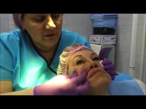 Видео: Мастер класс филлерами IVOIRE, компания "Инновация"