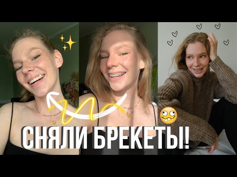 Видео: МНЕ СНЯЛИ БРЕКЕТЫ! // Реакция друзей