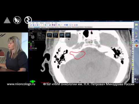 Видео: Современные инструменты для оконтуривания и 3D дозиметрического планирования. Лиепа З.