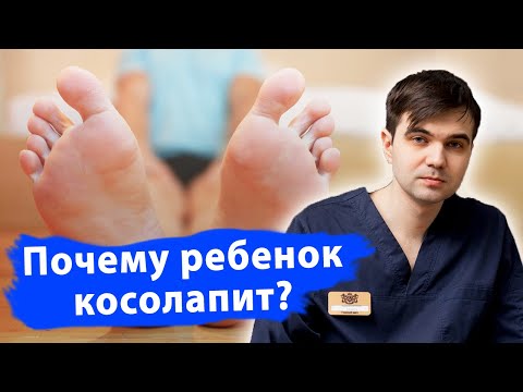 Видео: Почему ребёнок косолапит?