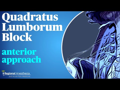 Видео: Блокада квадратной мышцы поясницы (QL): передний доступ