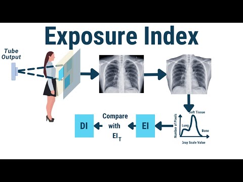 Видео: Индекс экспозиции (DEI, EI, REX), индекс отклонения (DI)