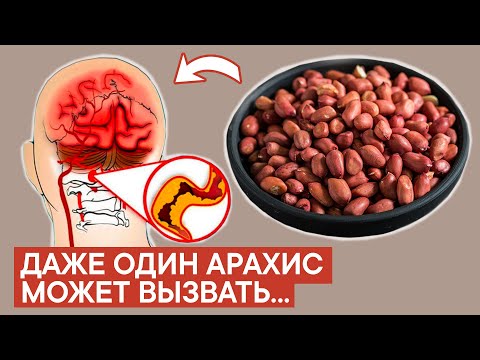 Видео: Многие ели или едят АРАХИС, но НЕ ДОГАДЫВАЮТСЯ какое действие он оказывает!