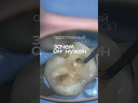 Видео: Адаптивный слой