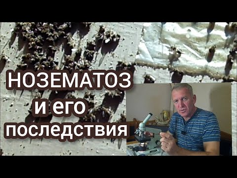 Видео: Нозематоз пчел. Как самому сделать анализ пчел.