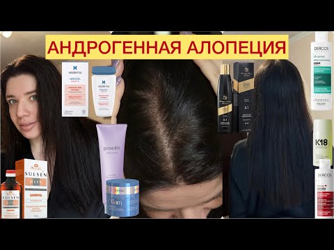 Видео: Устраните АНДРОГЕННУЮ АЛОПЕЦИЮ! Как шампунь может помочь? ВЫПАДЕНИЕ ВОЛОС. АГА. Очищение кожи головы