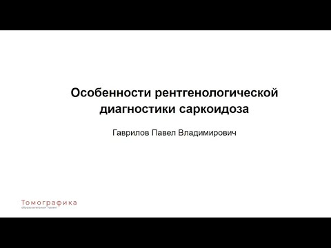 Видео: Особенности рентгенологической диагностики саркоидоза