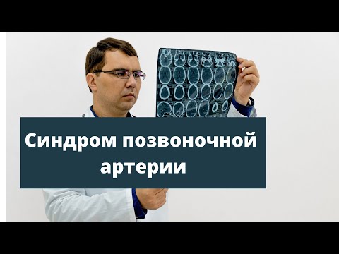 Видео: Синдром позвоночной артерии: диагностика и лечение