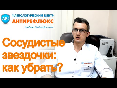 Видео: Сосудистые звездочки на теле, как убрать сосудистые сеточки на ногах?