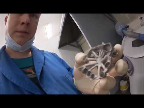 Видео: Литьё коронок в реальности