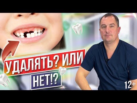 Видео: Нужно ли удалять молочные зубы у детей?! | К чему приводит удаление молочных зубов?!