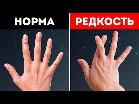 Видео: Странные способы, которыми ваше тело отличается от других