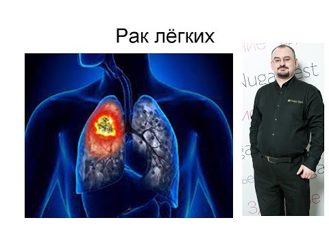 Видео: Рак легких