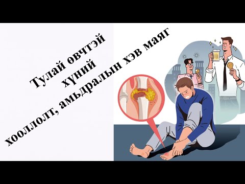 Видео: Тулай өвчтэй хүний анхаарах зүйлс