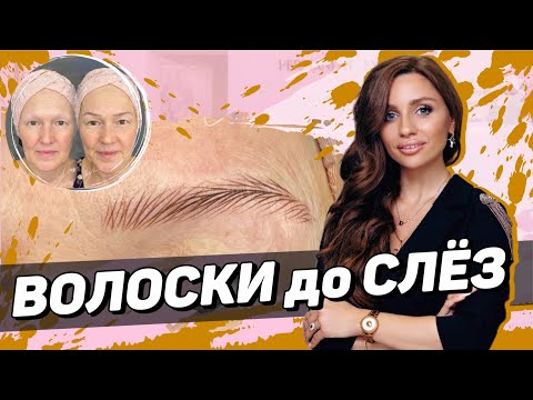 Видео: Волосковая техника при алопеции –ПРОЦЕСС ОТ НАЧАЛА И ДО КОНЦА. Мастер класс для мастеров пм