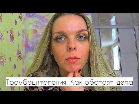 Видео: Тромбоцитопения. Чем лечу, как моё состояние сегодня. Год болезни за 10 минут. Синяки. (((