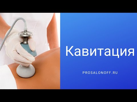 Видео: Кавитация - что это за процедура, отзывы, результат до и после