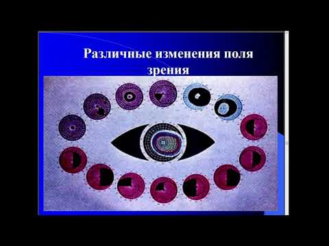Видео: 9:40 Зрительные функции. Нарушение бинокулярного зрения.