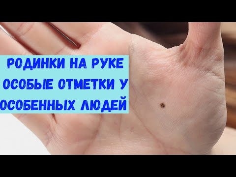 Видео: Родинки на руке (на холмах и линиях)/Хиромантия/коррекционная хиромантия