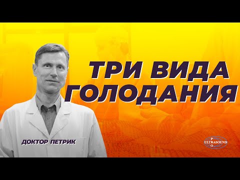 Видео: Стиль голодания по- разному влияет на организм. Как выбрать подходящее вам.