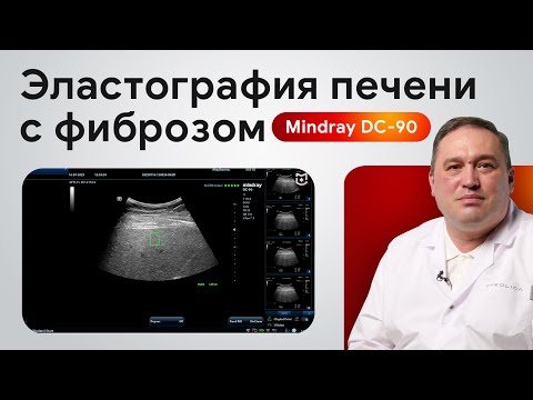 Видео: Эластография печени на Mindray DC-90: диагностика фиброза