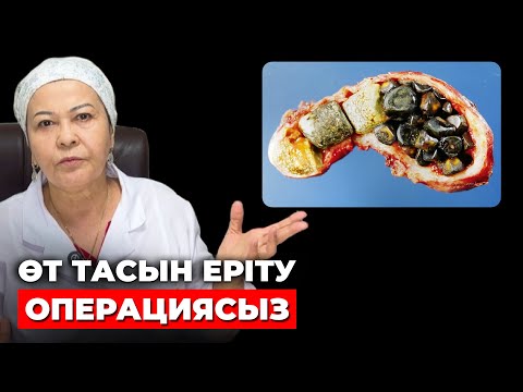 Видео: 31 жылдық дәрігер ескертеді ! | Өттегі тасты еріту | Өт тасын түсіру жолдары