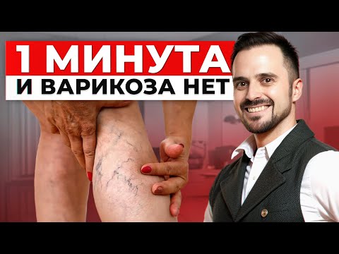 Видео: СЕКРЕТ, который скрывают врачи! / ЛУЧШЕЕ упражнение против ВАРИКОЗА