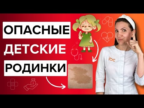 Видео: ОПАСНЫЕ родинки у детей. Из-за чего действительно стоит переживать, а из-за чего нет.