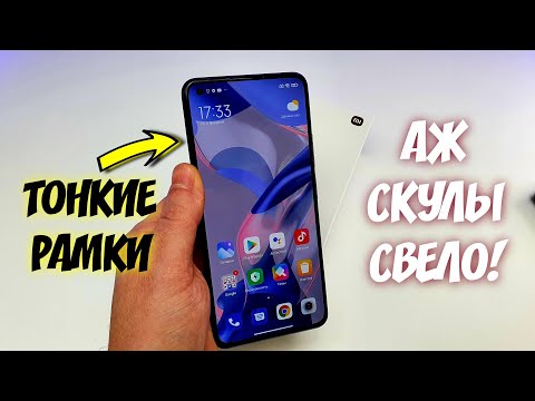Видео: Купил НОВЫЙ XIAOMI 11 LITE 5G NE и АЖ СКУЛЫ СВЕЛО! 😱ТОНКИЕ РАМКИ - ТОП сяоми