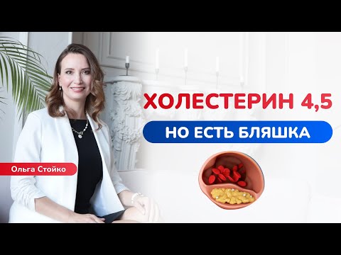 Видео: Если с холестерином все хорошо, откуда берутся бляшки в сосудах?