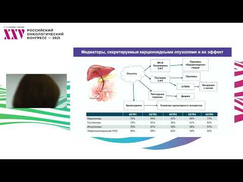 Видео: Нейроэндокринные неоплазии – сегодняшний день и будущие перспективы