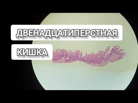 Видео: ДВЕНАДЦАТИПЕРСТНАЯ КИШКА