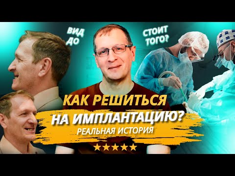 Видео: Имплантация зубов на верхней челюсти во сне. Как мы восстановили нашему пациенту все верхние зубы.