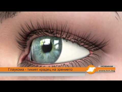 Видео: Глаукома – тихият крадец на зрението