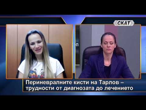 Видео: Периневралните кисти на Тарлов – трудности от диагнозата до лечението