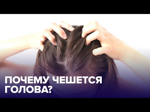 Видео: Почему ЧЕШЕТСЯ ГОЛОВА и как избавиться от ЗУДА?