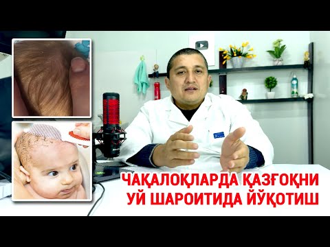 Видео: Чақалоқларда қазғоқни уй шароитида йўқотиш #doctorYakubjonov