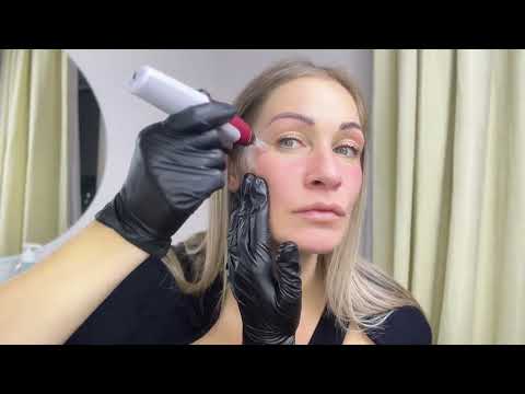 Видео: Фракционный аппарат Дермапен Dr pen N2 ⚡ Обзор топового электро Мезороллера для кожи лица и тела