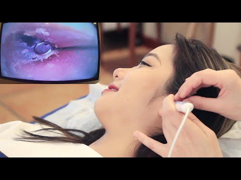 Видео: 【ASMR】Испытайте самую профессиональную визуальную чистку ушной серы! расслабляй массаж ушей!