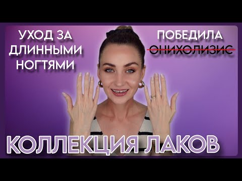 Видео: МОЯ КОЛЛЕКЦИЯ ЛАКОВ, УХОД ЗА ДЛИННЫМИ НОГТЯМИ, ДОМАШНИЙ МАНИКЮР | ПОБЕДИЛА ОНИХОЛИЗИС: МОЯ ИСТОРИЯ