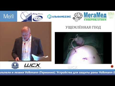 Видео: Конференция "Тонкости и уловки в экстренной лапароскопии"
