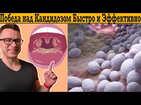 Видео: Быстрая победа над Кандидозом!